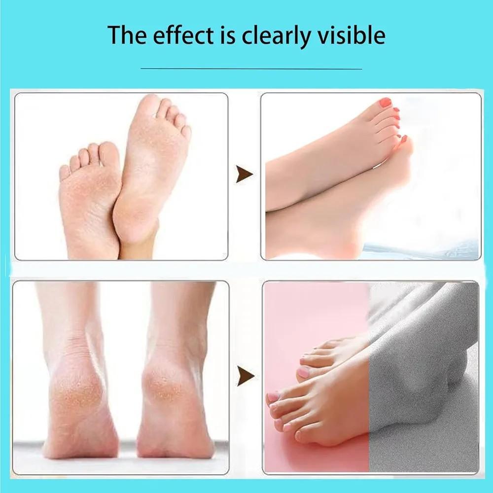 Electric Foot Callus Remover Pink with Replacement Heads - Image 3