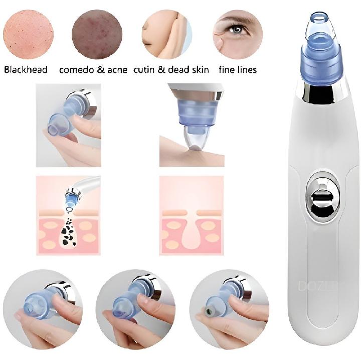 Derma Suction Facial Cleanser 4 Tips ABS Black Bottle - Image 7